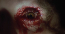 Bloodshot.